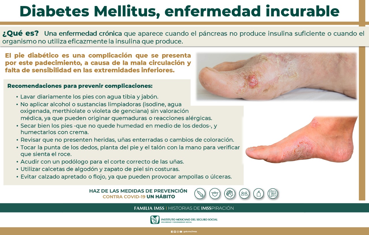 Informa IMSS Chihuahua sobre pie diabético y cómo prevenirlo para evitar  complicaciones - ENCORTO NEWS